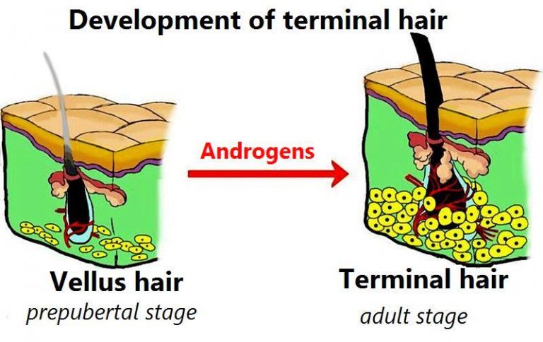 What Is The Difference Between Vellus And Terminal Hair Pediaa Com