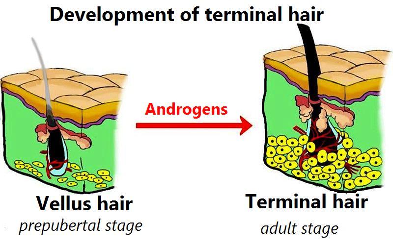 What is the Difference Between Vellus and Terminal Hair What is the Difference Between Vellus and Terminal Hair