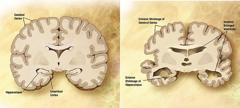 Difference Between Aging and Senescence
