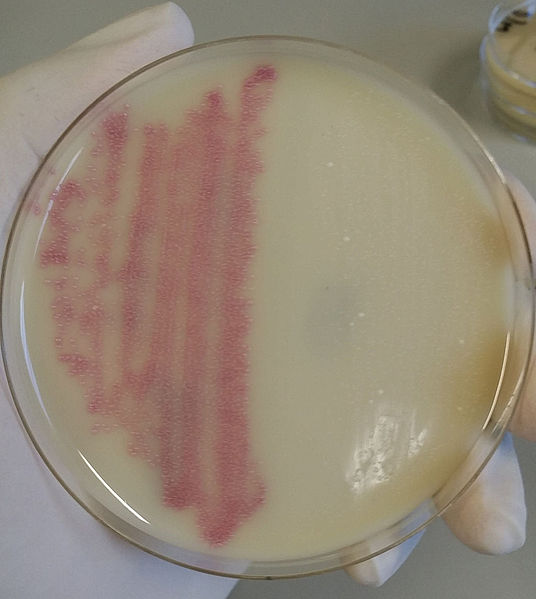 Difference Between HA-MRSA and CA-MRSA