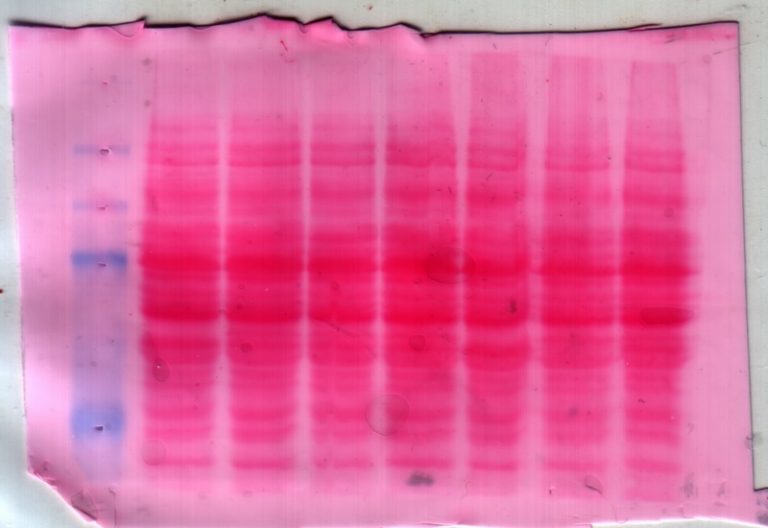 What is the Difference Between Nitrocellulose and PVDF Membrane