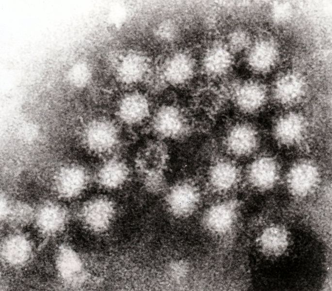 Difference Between Norovirus and Rotavirus