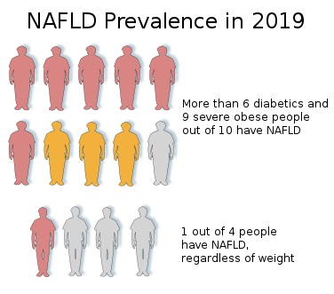 Main Difference - NASH vs NAFLD