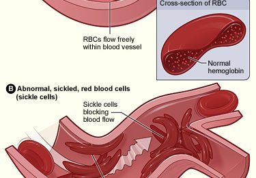 Difference Between Acidosis and Alkalosis | Definition, Disease ...