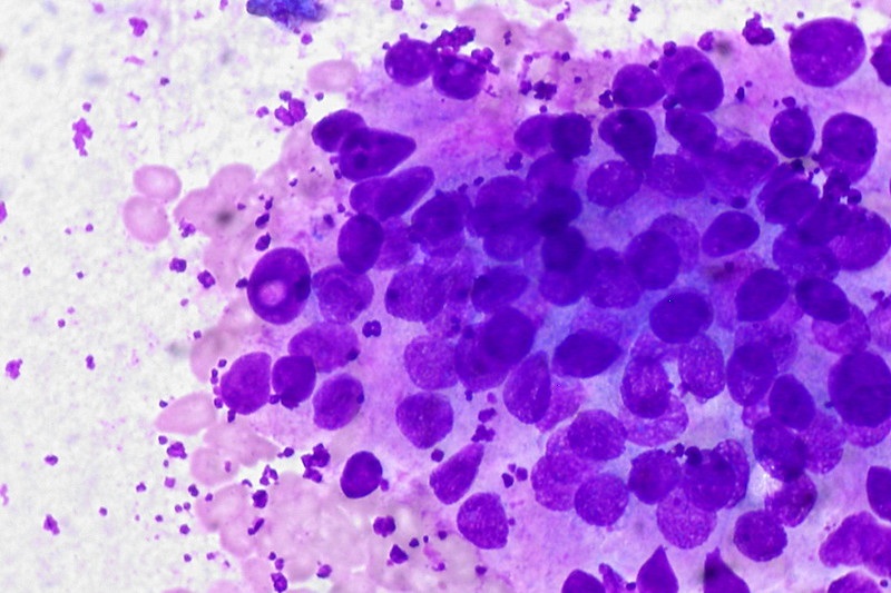 Difference Between Giemsa Stain and Wright Stain
