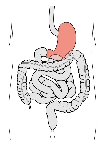Main Difference - Stomach vs Gut