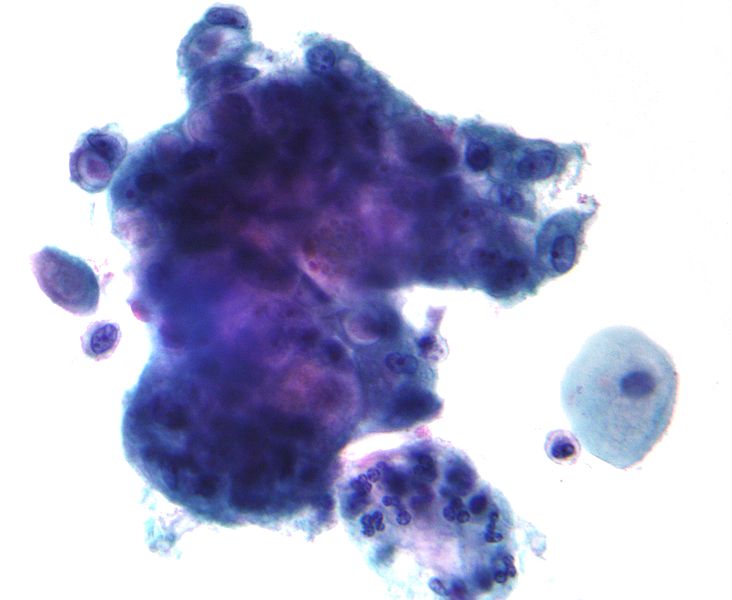 Compare Mucin and Mucus - What's the difference?