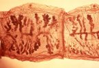 Flukes vs Tapeworms