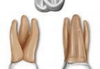 Maxillary vs Mandibular Molars