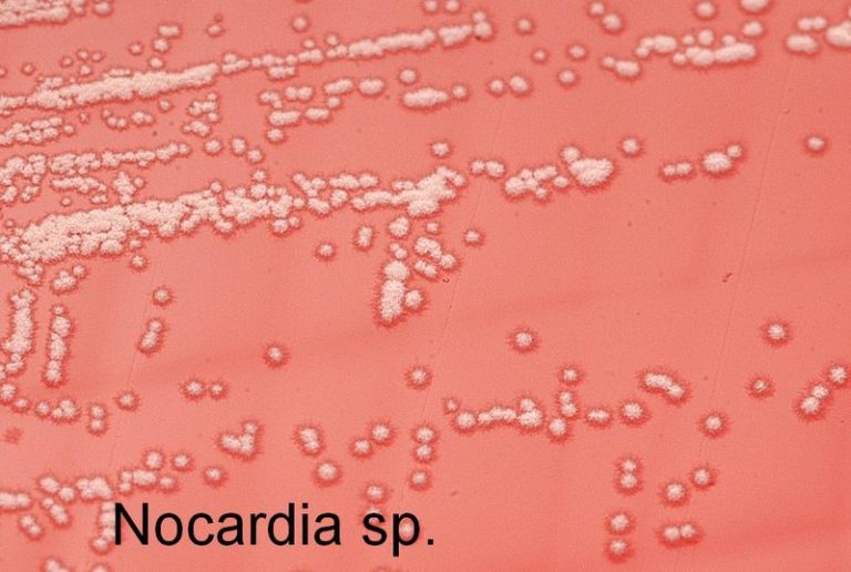 What is the Difference Between Nocardia and Actinomyces