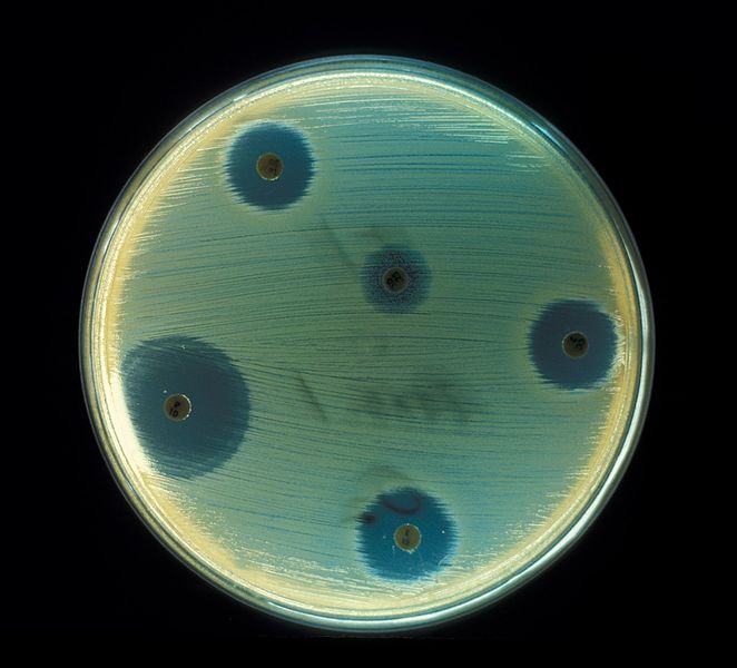 Compare Antibiotic and Anti-inflammatory - What's the difference?
