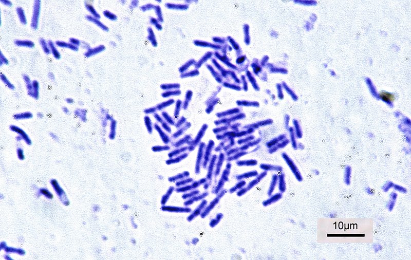 Compare Bacteria and Mollicutes