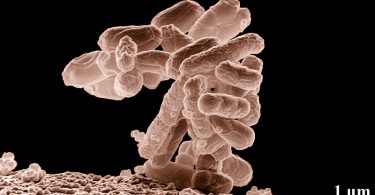 Comapre Coliform and Enterobacteriaceae - What's the difference?