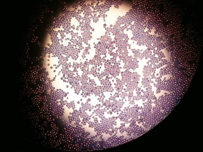 Compare Saccharomyces Cerevisiae and Candida Albicans - What's the difference?