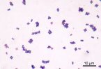 Compare Staphylococcus Aureus and Streptococcus Pyogenes