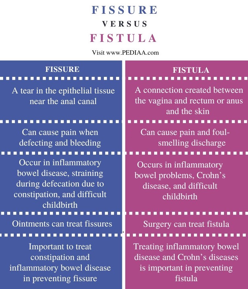 Difference Between Fissure and Fistula - Comparison Summary