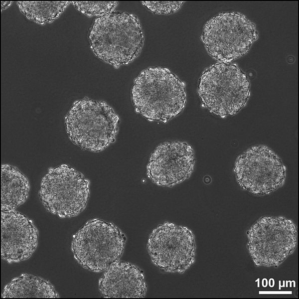 Callus Culture vs Cell Suspension Culture