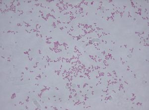 What is the Difference Between Klebsiella Oxytoca and Klebsiella ...