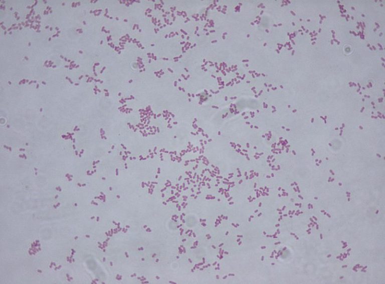 What is the Difference Between Klebsiella Oxytoca and Klebsiella