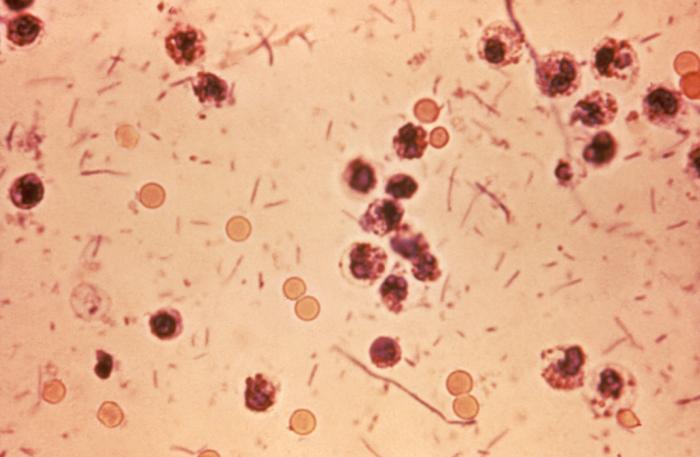 Comapre Shigella and Salmonella