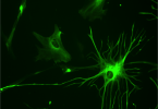 Compare Astrocytes and Microglia