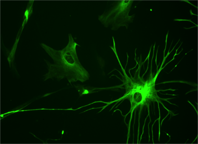 Compare Astrocytes and Microglia