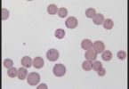 Compare Mycoplasma and PPLO - What is the Difference?