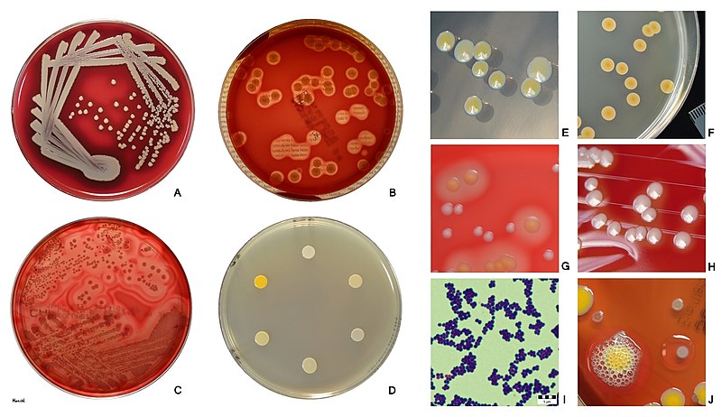 Compare Pathogenic and Non-pathogenic Staphylococcus