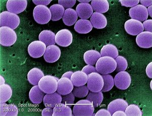 What is the Difference Between Staphylococcus Aureus and Staphylococcus ...