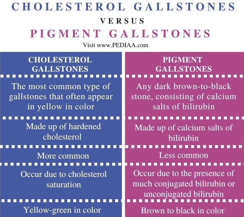 Cholesterol vs Pigment Gallstones - Comparison Summary