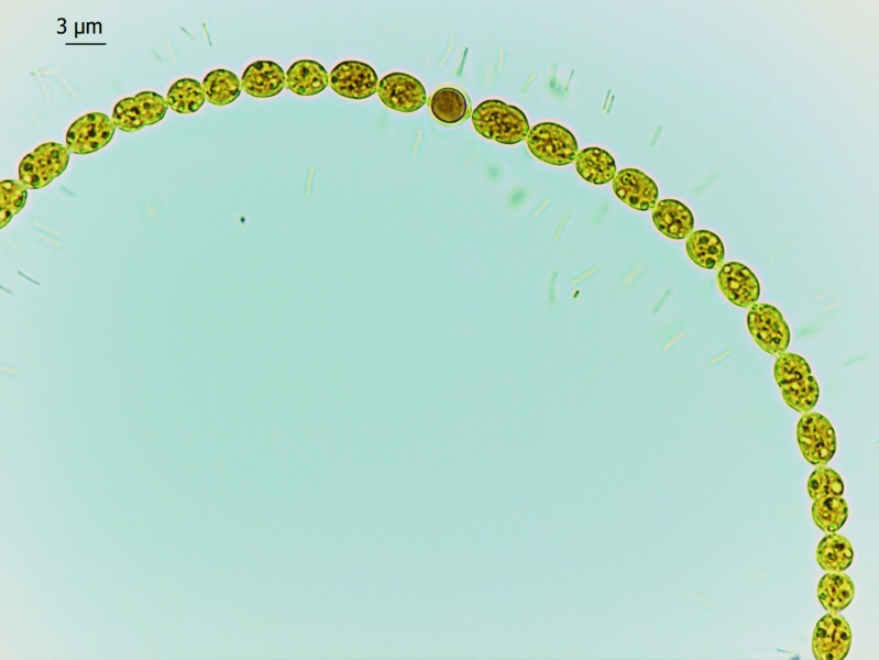 Heterocyst vs Vegetative Cell