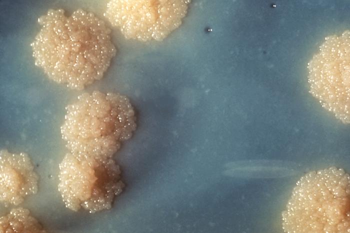 Compare Mycobacterium Tuberculosis and Nontuberculous Mycobacteria
