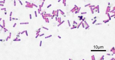 Compare Bacillus and Clostridium - What's the difference?
