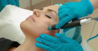 Compare Microneedling vs Microdermabrasion