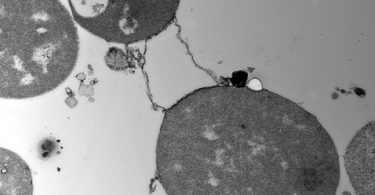 L-form Bacteria vs Mycoplasma