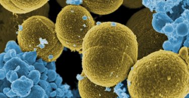 Compare Staphylococcus Aureus and Enterococcus Faecalis - What's the difference?