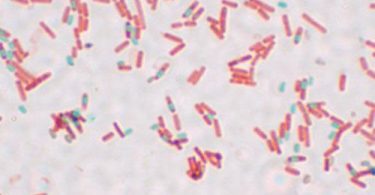 Compare Bacillus Subtilis and Bacillus Cereus