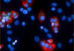 Compare Alpha and Beta Cells - What's the difference?