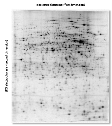 What is the Difference Between 1D and 2D Gel Electrophoresis - Pediaa.Com