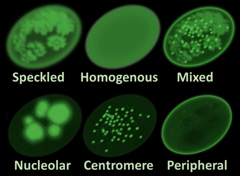 What is the difference between direct and indirect immunofluorescence
