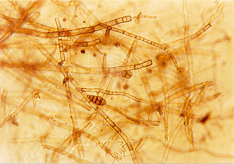 What is the Difference Between Septate and Aseptate Hyphae - Pediaa.Com