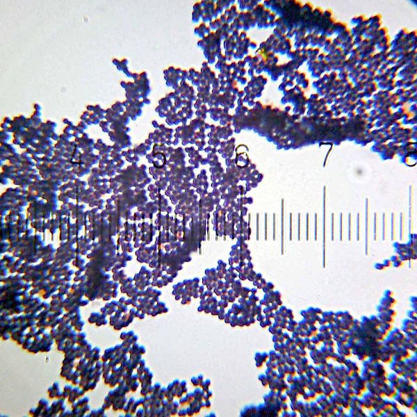 Difference Between Staph And Golden Staph