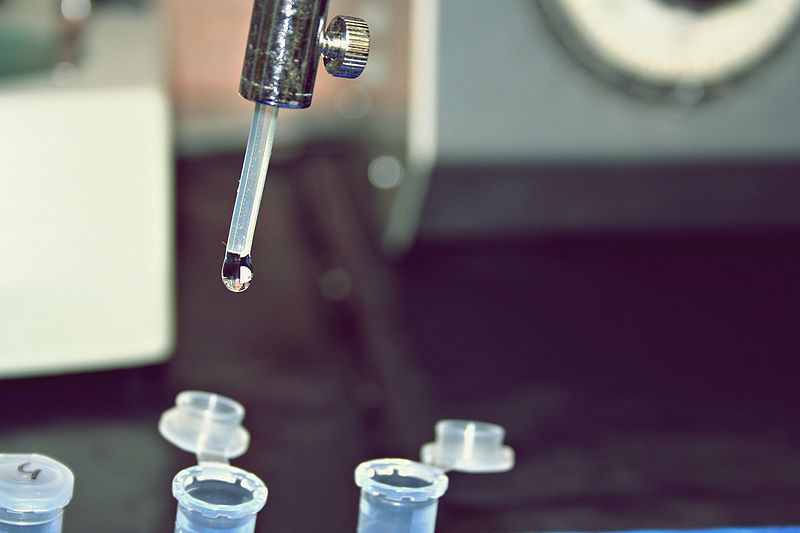 What is the Difference Between Gel Filtration and Ion Exchange