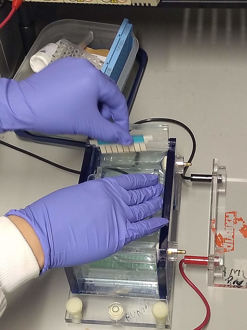 What is the Difference Between Stacking Gel and Separating Gel